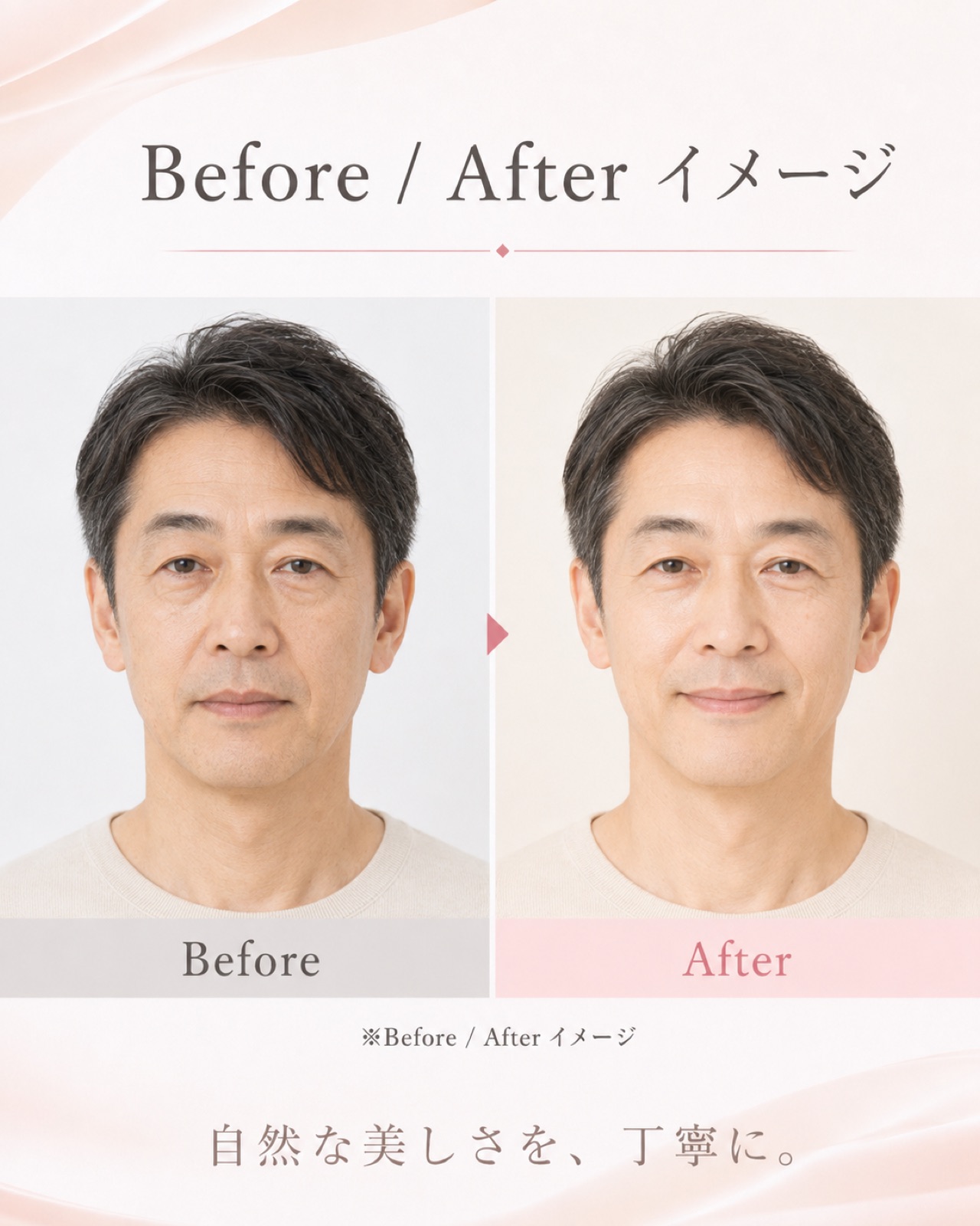 症例写真4